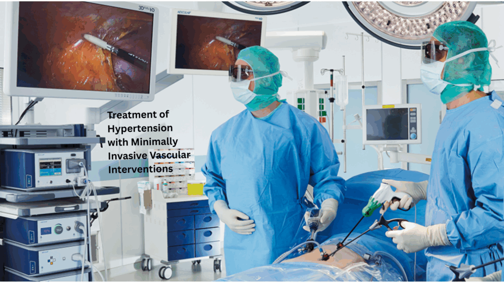 Two surgeons in blue surgical gowns and masks performing a minimally invasive vascular procedure, with medical monitors displaying the inside view of the patient’s body. Text on the image reads: “Treatment of Hypertension with Minimally Invasive Vascular Interventions.