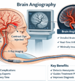 Medical illustration showing cerebral blood vessels during a brain angiography procedure, highlighting safety and precision.