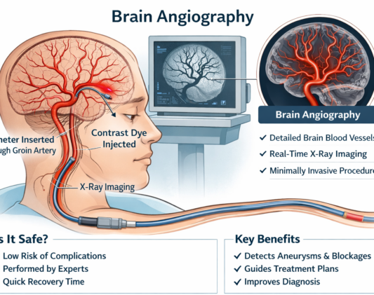 Medical illustration showing cerebral blood vessels during a brain angiography procedure, highlighting safety and precision.